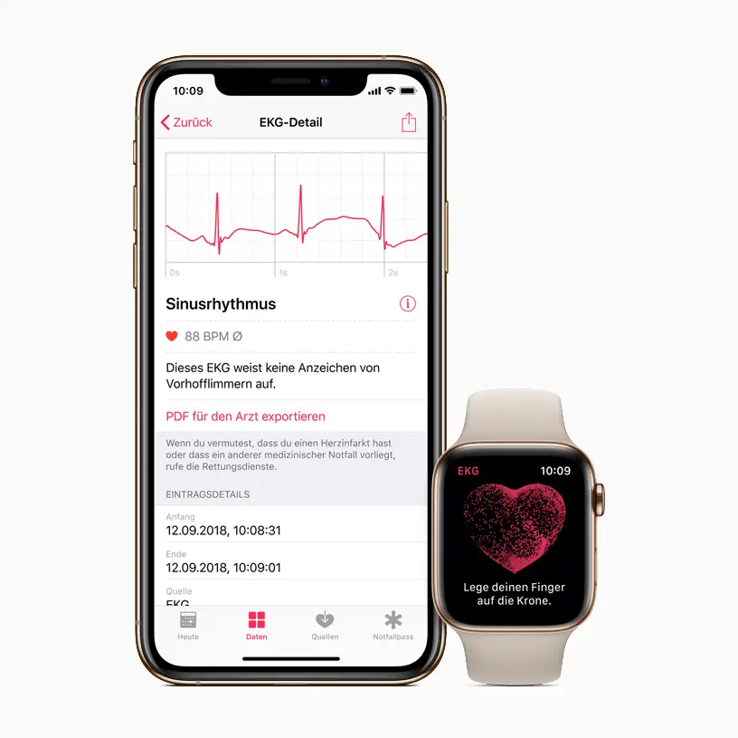 Apple Watch EKG Messung